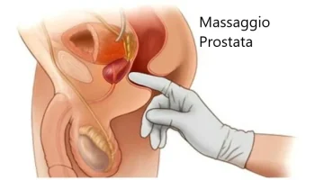 massaggioprostata2